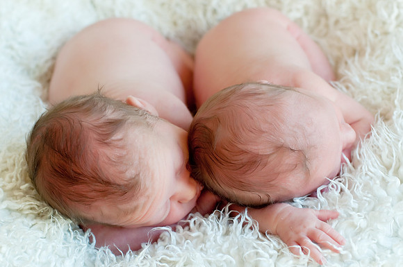 Albertson Twins-25